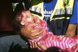 injured baby kiryat malachi