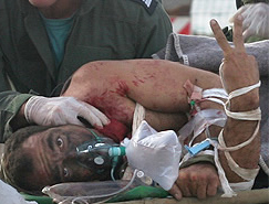 An IDF soldier treated by Rambam after a brutal attack