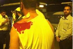 ISRAeli bus driver stabbed by arab october 10 2012