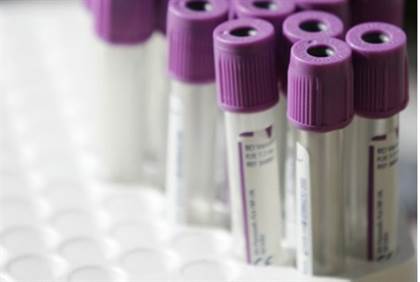 israeli develops blood test to detect breast cancer
